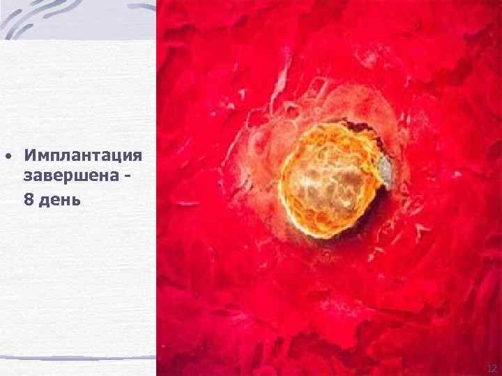  • Имплантация завершена 8 день 12 