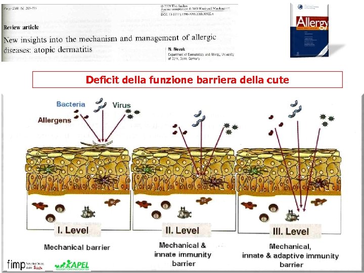 Deficit della funzione barriera della cute 