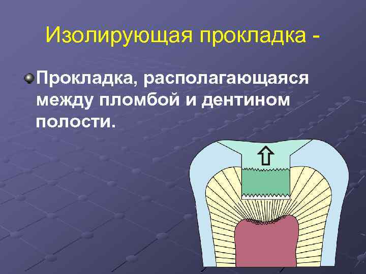 Изолирующая прокладка Прокладка, располагающаяся между пломбой и дентином полости. 