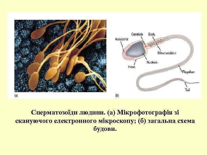Сперматозоїди людини. (а) Мікрофотографія зі скануючого електронного мікроскопу; (б) загальна схема будови. 