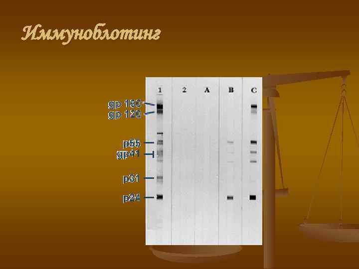 Иммуноблотинг 