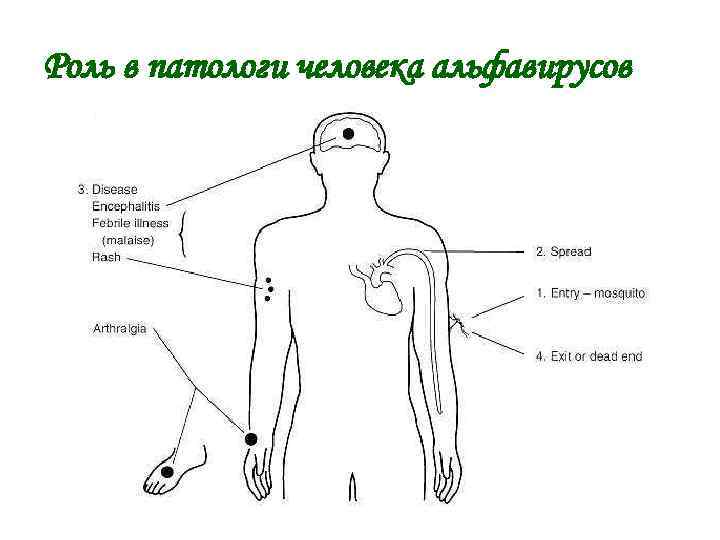 Роль в патологи человека альфавирусов 