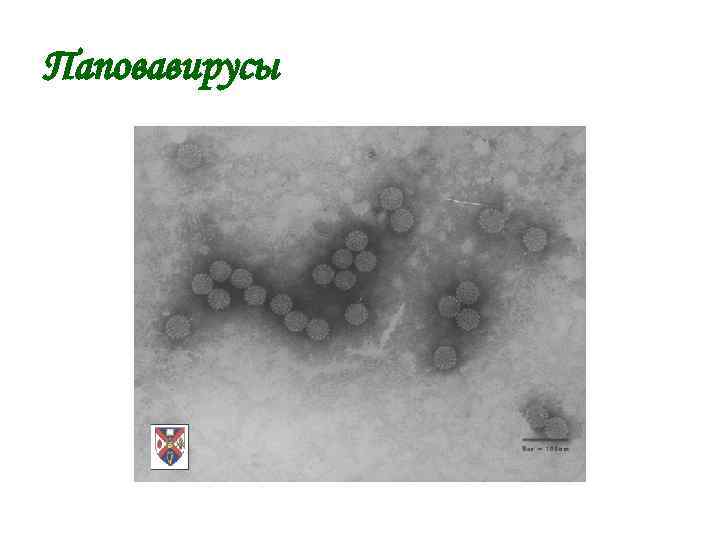 Паповавирусы 