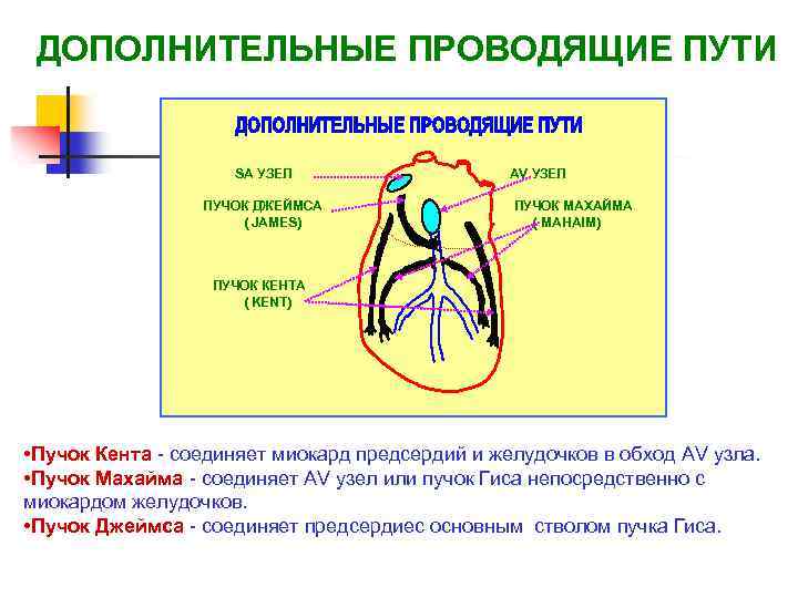 ДОПОЛНИТЕЛЬНЫЕ ПРОВОДЯЩИЕ ПУТИ SA УЗЕЛ ПУЧОК ДЖЕЙМСА (JAMES) AV УЗЕЛ ПУЧОК МАХАЙМА ( MAHAIM)