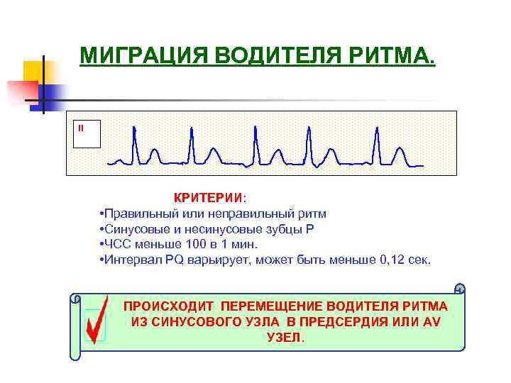 Миграция водителя ритма на экг у ребенка причины