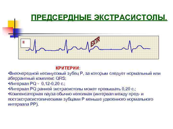Предсердные экстрасистолы. Аберрантная суправентрикулярная экстрасистолия. Аберрантная наджелудочковая экстрасистола. Аберрантная предсердная экстрасистола. Аберрантные экстрасистолы на ЭКГ.