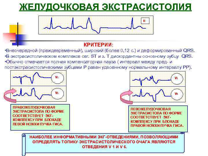 ЖЕЛУДОЧКОВАЯ ЭКСТРАСИСТОЛИЯ II КРИТЕРИИ: • Внеочередной (преждевременный), широкий (более 0, 12 с. ) и