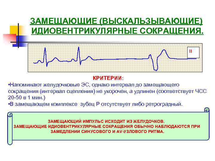 ЗАМЕЩАЮЩИЕ (ВЫСКАЛЬЗЫВАЮЩИЕ) ИДИОВЕНТРИКУЛЯРНЫЕ СОКРАЩЕНИЯ. II КРИТЕРИИ: • Напоминают желудочковые ЭС, однако интервал до замещающего
