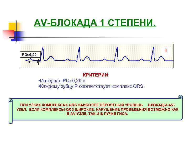 Блокада первой степени. АВ блокада интервал PQ. Av блокада 1 степени. Ab блокада 1степени с интервалом PQ. Удлинение интервала PQ.