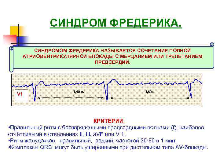 Синдром фредерика на экг фото