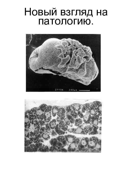 Новый взгляд на патологию. 