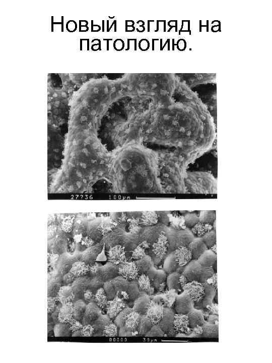 Новый взгляд на патологию. 