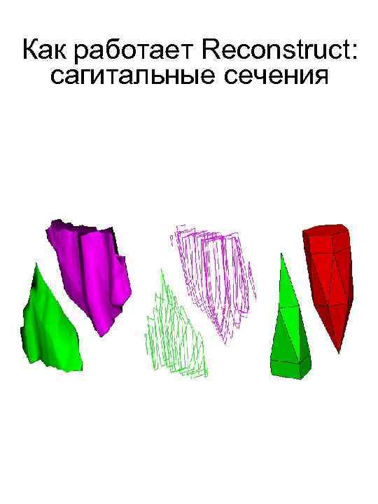 Как работает Reconstruct: сагитальные сечения 