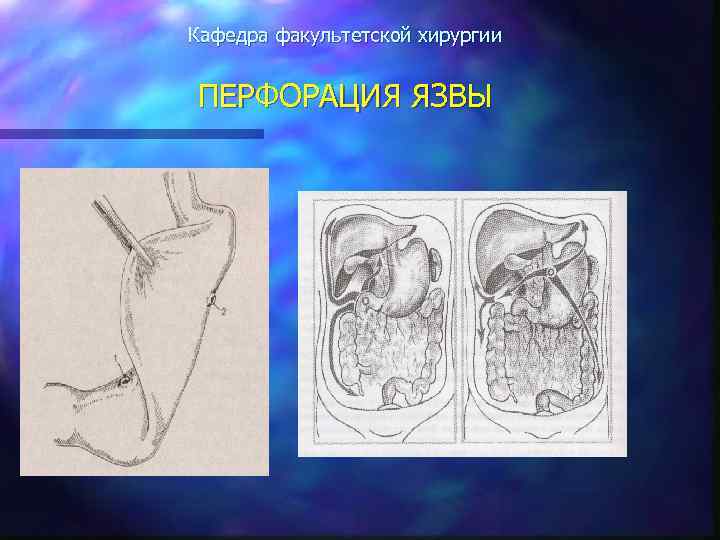 Факультетская хирургия