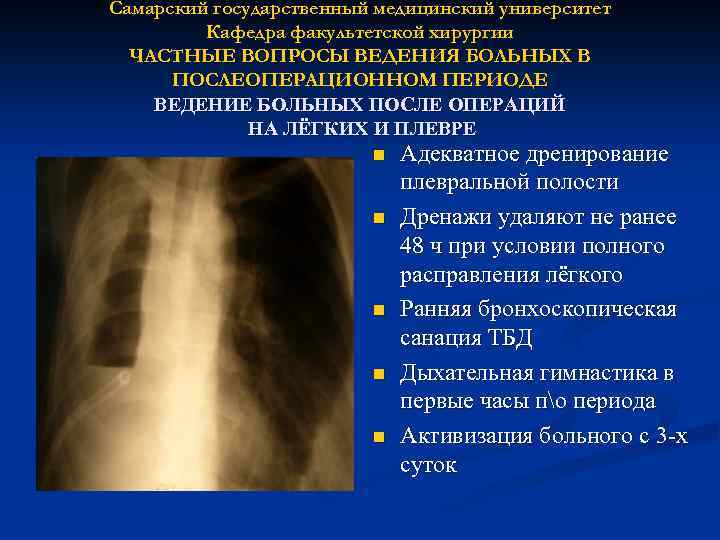 Самарский государственный медицинский университет Кафедра факультетской хирургии ЧАСТНЫЕ ВОПРОСЫ ВЕДЕНИЯ БОЛЬНЫХ В ПОСЛЕОПЕРАЦИОННОМ ПЕРИОДЕ