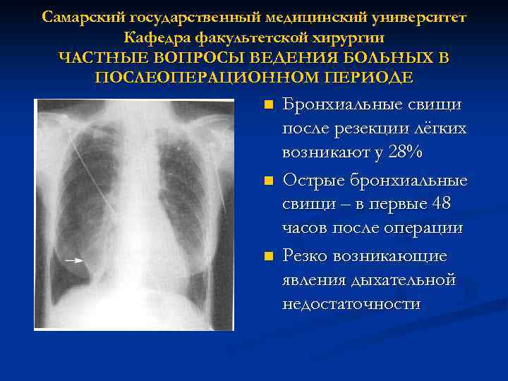 Самарский государственный медицинский университет Кафедра факультетской хирургии ЧАСТНЫЕ ВОПРОСЫ ВЕДЕНИЯ БОЛЬНЫХ В ПОСЛЕОПЕРАЦИОННОМ ПЕРИОДЕ