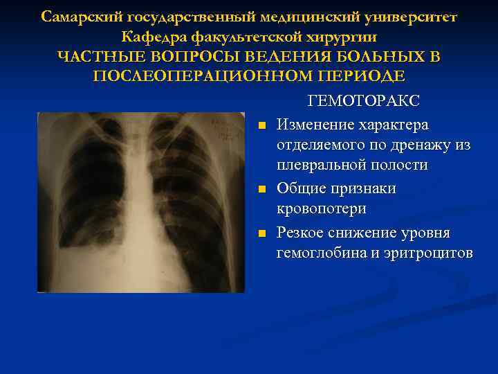 Самарский государственный медицинский университет Кафедра факультетской хирургии ЧАСТНЫЕ ВОПРОСЫ ВЕДЕНИЯ БОЛЬНЫХ В ПОСЛЕОПЕРАЦИОННОМ ПЕРИОДЕ