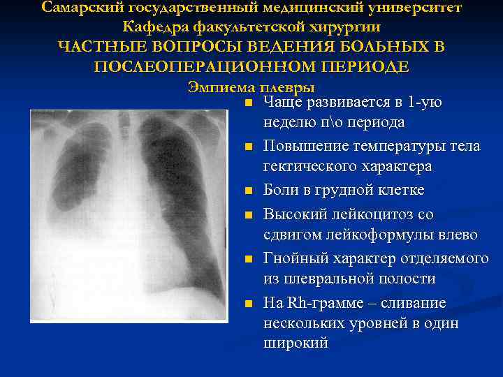 Самарский государственный медицинский университет Кафедра факультетской хирургии ЧАСТНЫЕ ВОПРОСЫ ВЕДЕНИЯ БОЛЬНЫХ В ПОСЛЕОПЕРАЦИОННОМ ПЕРИОДЕ