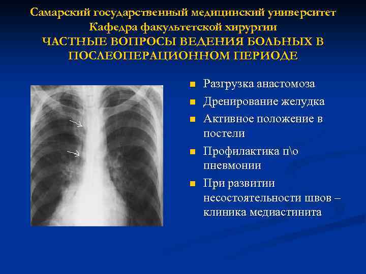 Самарский государственный медицинский университет Кафедра факультетской хирургии ЧАСТНЫЕ ВОПРОСЫ ВЕДЕНИЯ БОЛЬНЫХ В ПОСЛЕОПЕРАЦИОННОМ ПЕРИОДЕ