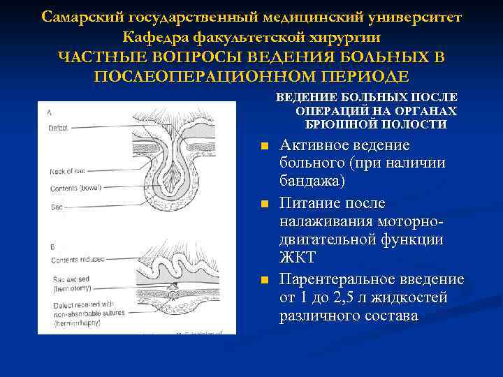 Самарский государственный медицинский университет Кафедра факультетской хирургии ЧАСТНЫЕ ВОПРОСЫ ВЕДЕНИЯ БОЛЬНЫХ В ПОСЛЕОПЕРАЦИОННОМ ПЕРИОДЕ