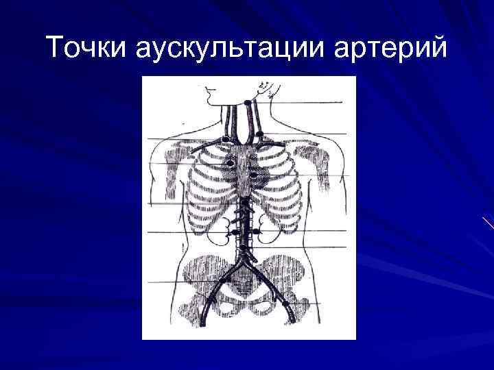 Точки аускультации артерий 