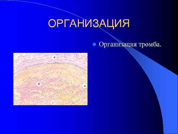 ОРГАНИЗАЦИЯ l Организация тромба. 