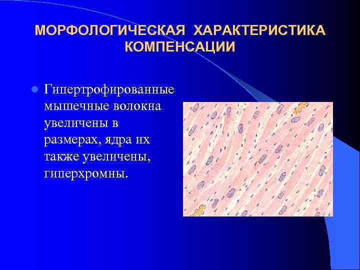 МОРФОЛОГИЧЕСКАЯ ХАРАКТЕРИСТИКА КОМПЕНСАЦИИ l Гипертрофированные мышечные волокна увеличены в размерах, ядра их также увеличены,