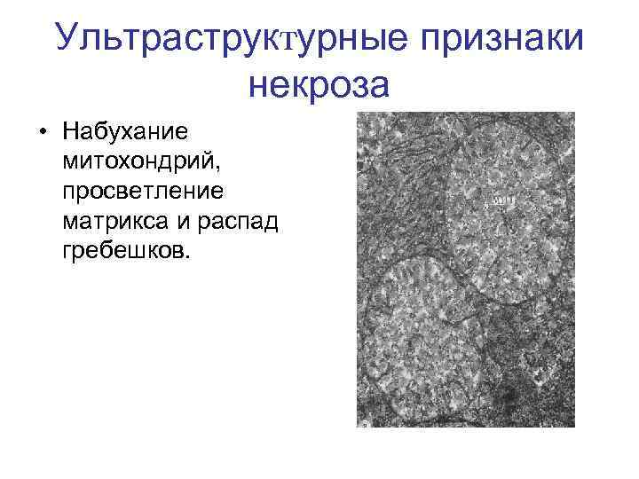 Ультраструктурные признаки некроза • Набухание митохондрий, просветление матрикса и распад гребешков. 