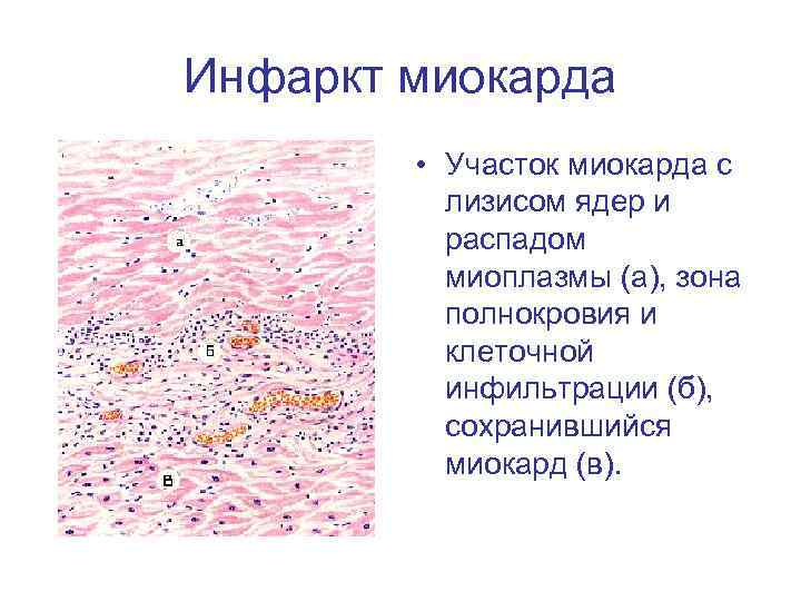 Миокард гистология рисунок