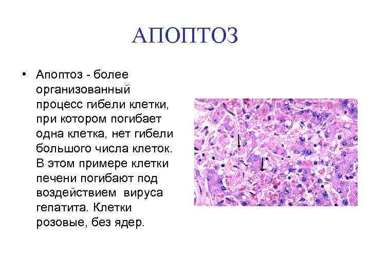 АПОПТОЗ • Апоптоз - более организованный процесс гибели клетки, при котором погибает одна клетка,