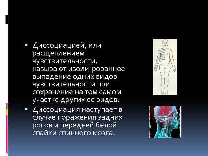  Диссоциацией, или расщеплением чувствительности, называют изоли рованное выпадение одних видов чувствительности при сохранение