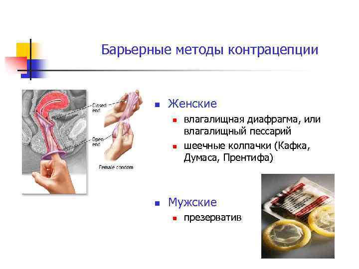 Барьерные методы контрацепции n Женские n n n влагалищная диафрагма, или влагалищный пессарий шеечные