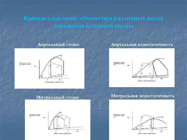 Кривые «давление- объем» при различных видах поражения клапанов сердца Аортальный стеноз Аортальная недостаточность Митральный