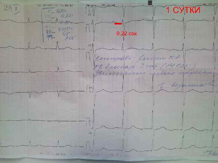 1 СУТКИ 0. 22 сек 