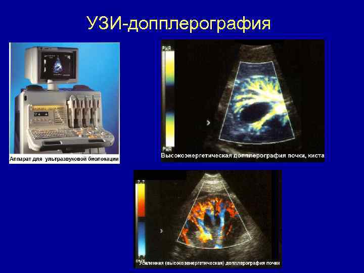 УЗИ-допплерография 