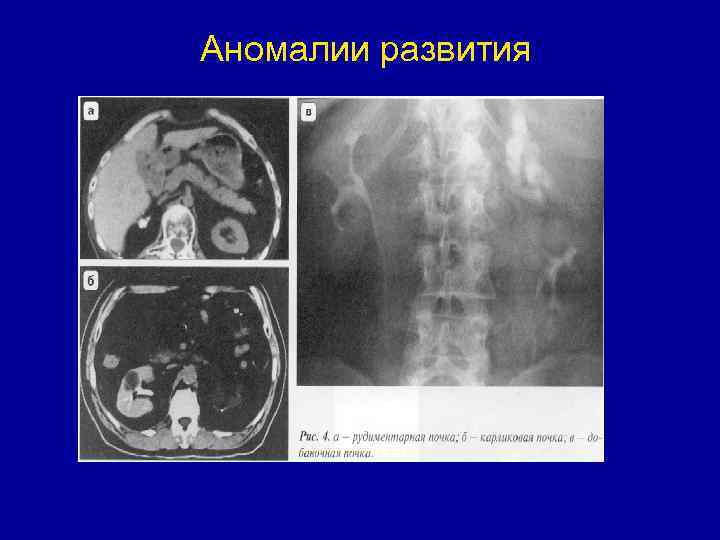 Аномалии развития 
