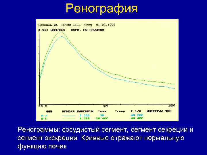 Ренография Ренограммы: сосудистый сегмент, сегмент секреции и сегмент экскреции. Криввые отражают нормальную функцию почек