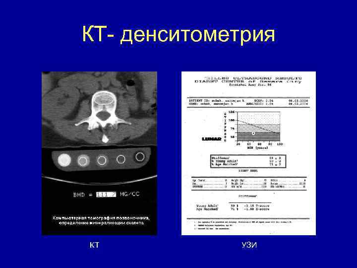 КТ- денситометрия КТ УЗИ 