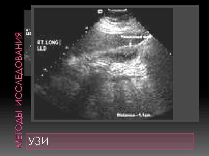 МЕТОДЫ ИССЛЕДОВАНИЯ УЗИ 
