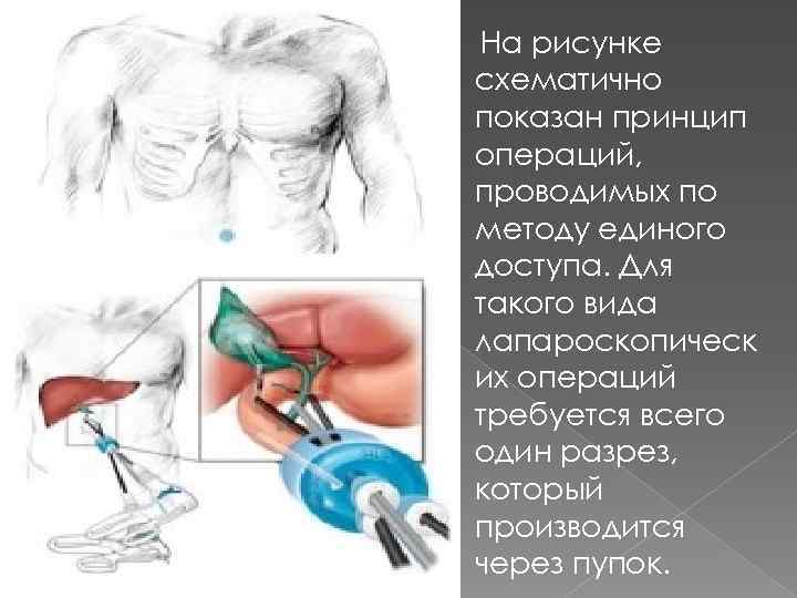 На рисунке схематично показан принцип операций, проводимых по методу единого доступа. Для такого вида