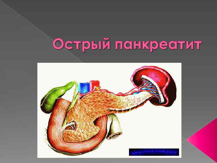 Острый панкреатит 