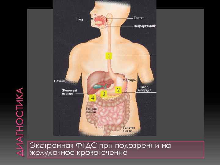 ДИАГНОСТИКА Экстренная ФГДС при подозрении на желудочное кровотечение 