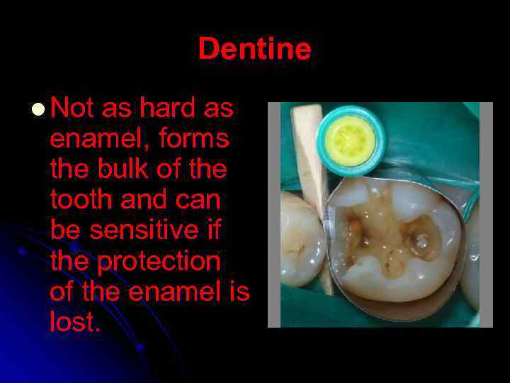 Dentine l Not as hard as enamel, forms the bulk of the tooth and