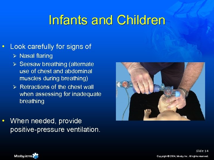 Infants and Children • Look carefully for signs of Ø Nasal flaring Ø Seesaw