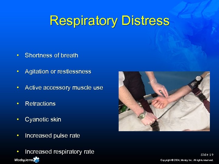Respiratory Distress • Shortness of breath • Agitation or restlessness • Active accessory muscle