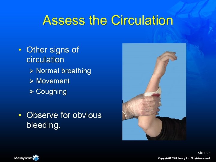 Assess the Circulation • Other signs of circulation Ø Normal breathing Ø Movement Ø