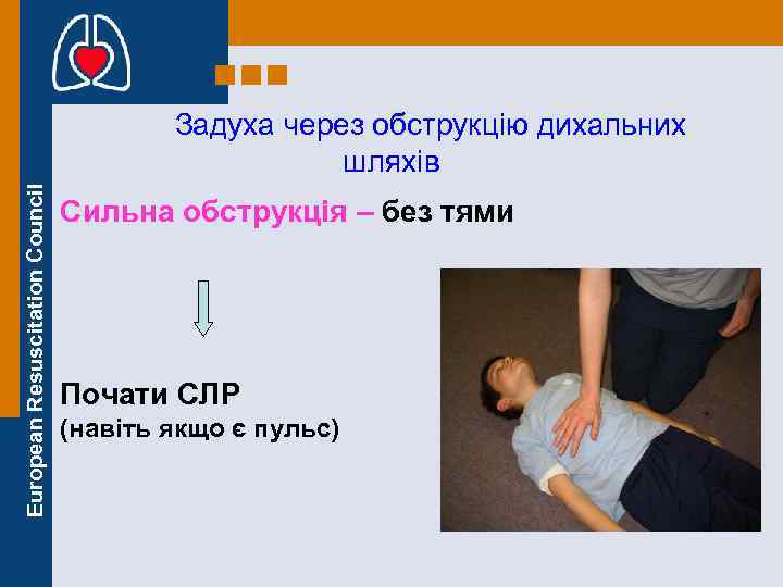 European Resuscitation Council Задуха через обструкцію дихальних шляхів Сильна обструкція – без тями Почати