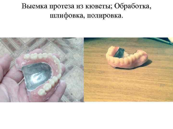Выемка протеза из кюветы; Обработка, шлифовка, полировка. 