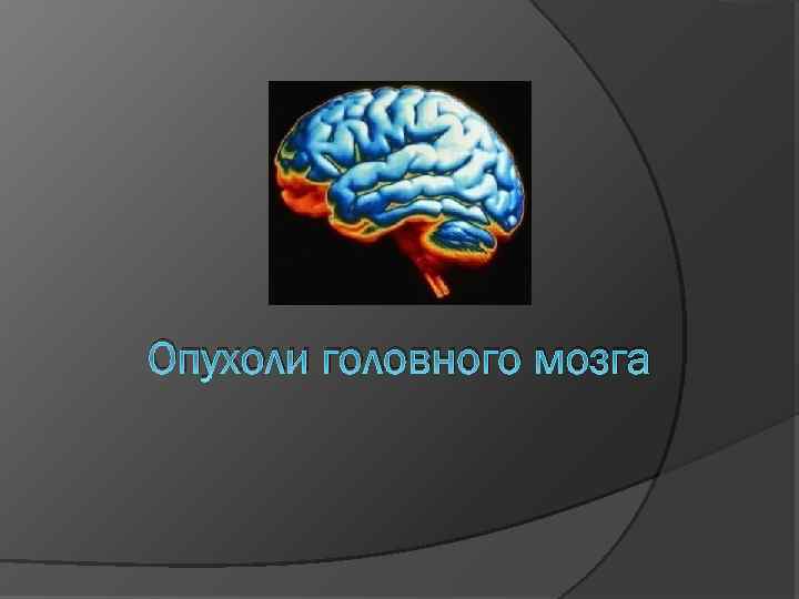 Опухоли головного мозга 