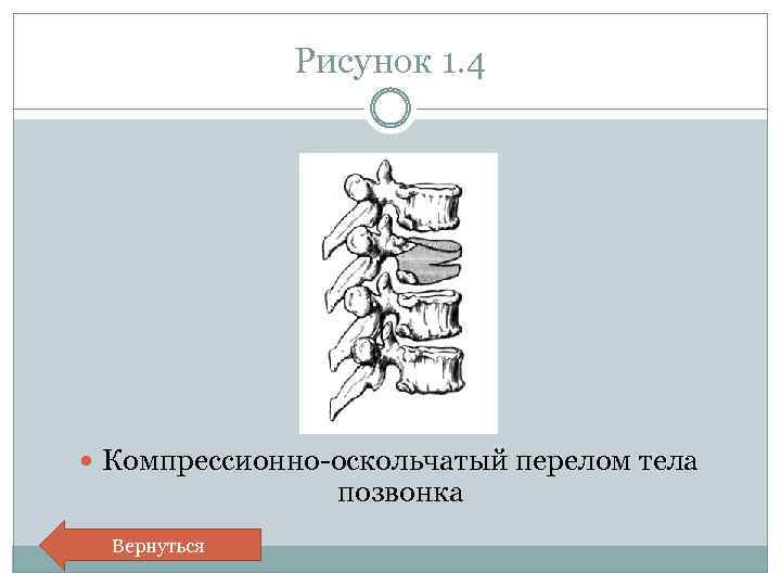 Перелом позвоночника рисунок